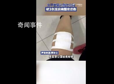 女子带娃路过公园 被3条流浪狗围攻