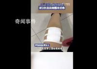 女子带娃路过公园 被3条流浪狗围攻