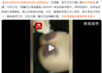 官方调查学生屁股被老师打成黑紫色 事件正在调查处理