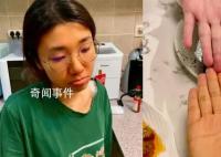 女子为减肥连吃3月胡萝卜变小橘人