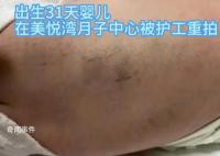 陕西月子会所护工把婴儿打成脑损伤