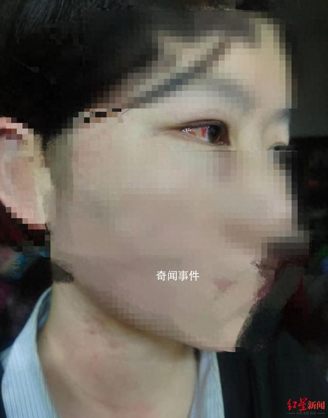 悬赏找打人者事件3人已被抓 3名施暴者均未成年