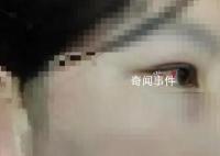 “女儿被打父亲万元悬赏寻凶”追踪