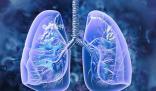 超六成公众对慢阻肺病完全不知道 11月15日是世界慢阻肺日