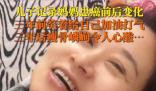 泪目!儿子记录妈妈患癌三年的变化