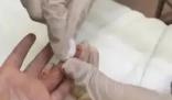 医生给孩子采血手套残留他人血迹 引发网友关注