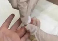 医生给孩子采血手套残留他人血迹 引发网友关注