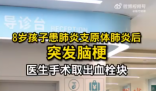 8岁男孩患肺炎支原体肺炎后突发脑梗 最终通过手术治疗小宝转危为安