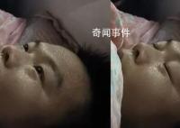 男子同时患甲流支原体烧到额头冒烟 网友：这下CPU要被干烧了