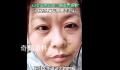42岁断崖式衰老女子确诊卵巢早衰
