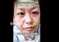 42岁断崖式衰老女子确诊卵巢早衰
