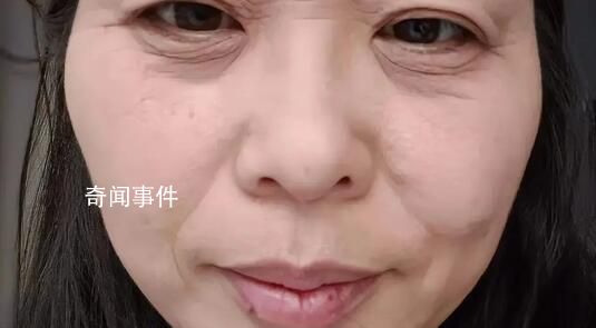 断崖式衰老女子本以为能漂亮过余生 引发网友热议