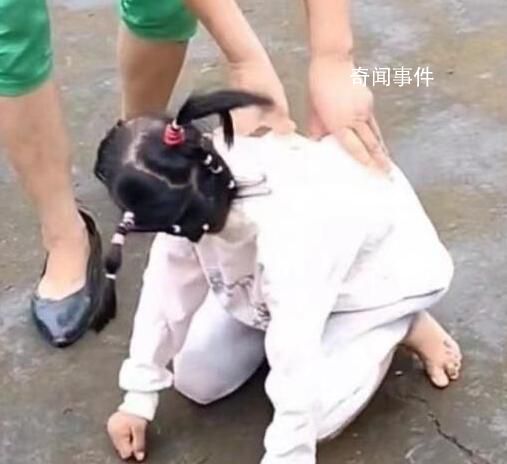 网红袖珍女孩疑遭母亲虐待 肢体2级残疾