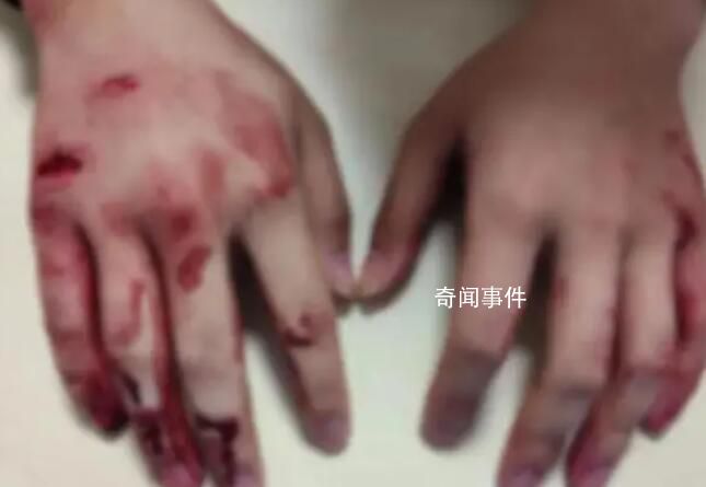 浙江“00后”小伙勇救车祸中母子