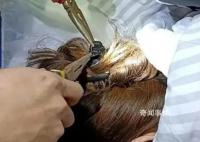 女子出车祸鲨鱼夹插入后脑勺