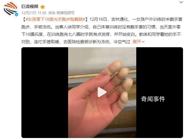 女孩零下18度户外光手跑步险截肢 室外运动防寒真不是小事
