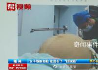 23岁女子腹胀如鼓取出42斤肿瘤