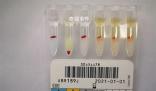 江苏泰州发现罕见小p血型 我国记录在案的小p血型仅有10余人