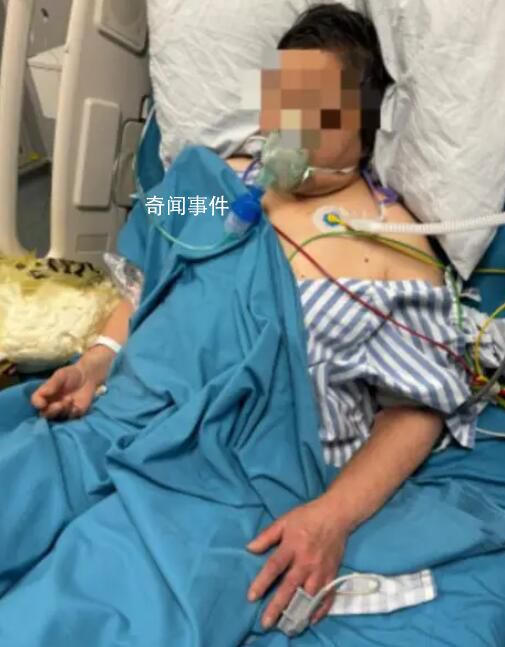 夫妻宰杀活鸭被抓伤住进ICU 俩人先后出现寒战发热的症状