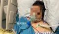 夫妻宰杀活鸭被抓伤住进ICU 俩人先后出现寒战发热的症状
